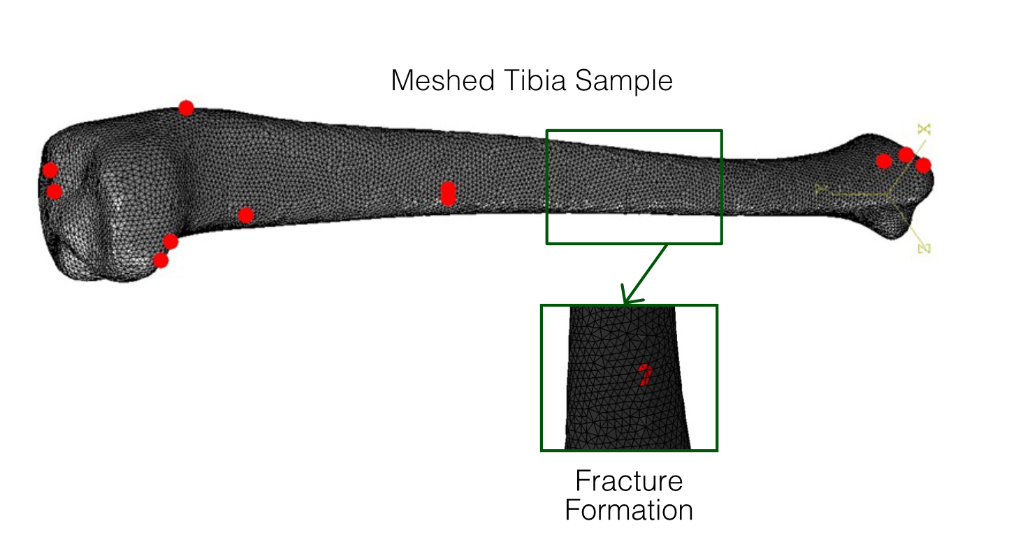 Tibia Stress