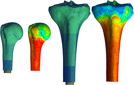 Tibia Stress Fracture Prediction